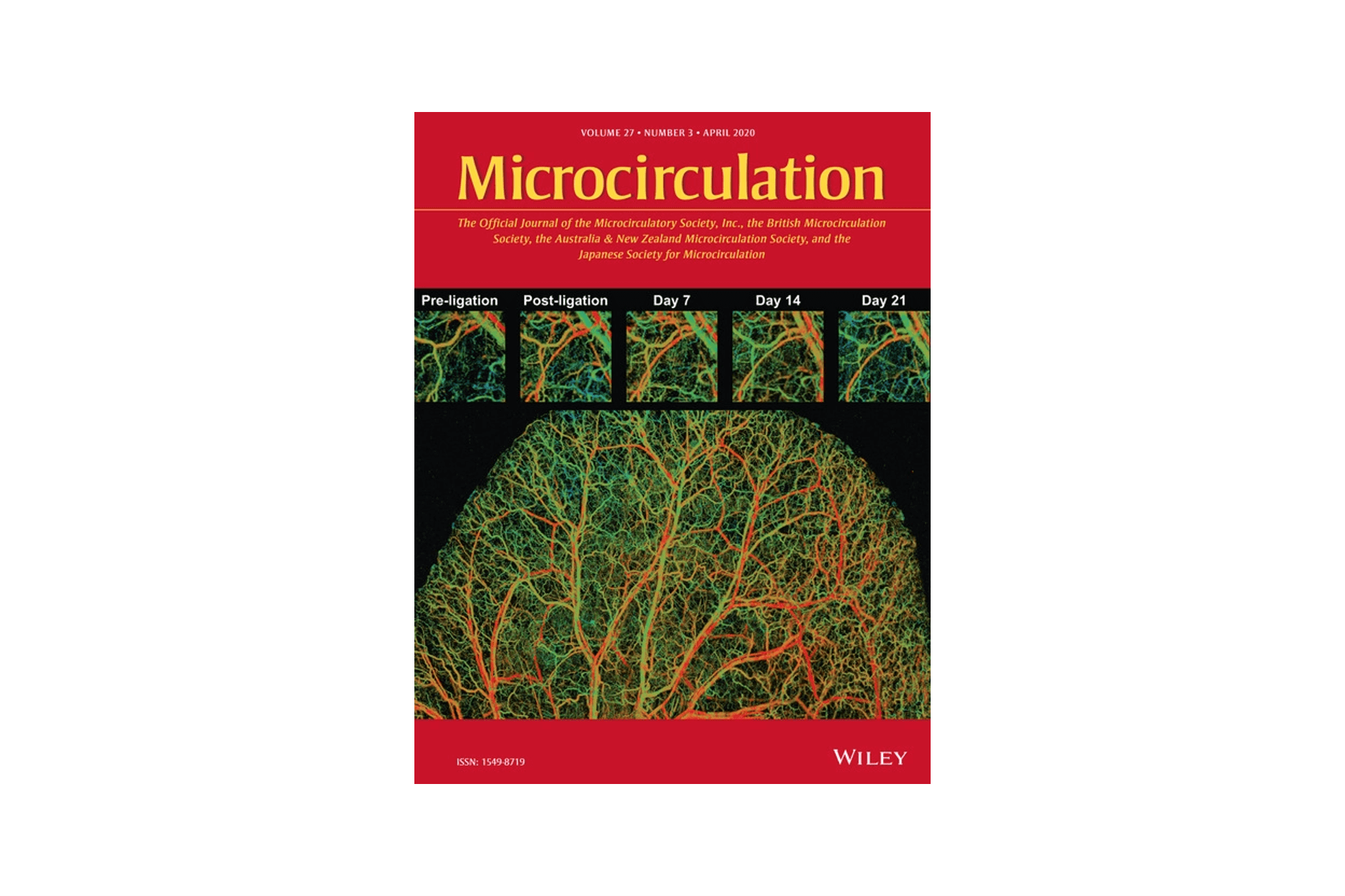 Naidi Sun’s paper is featured on the cover of Microcirculation