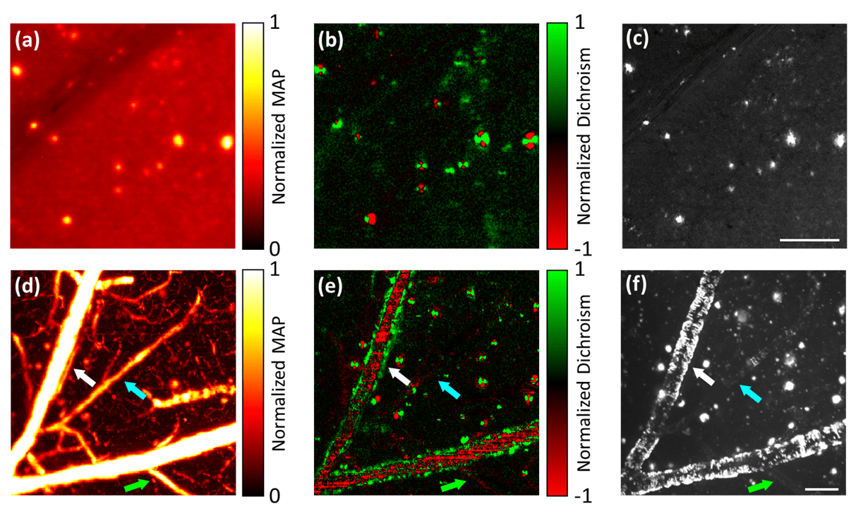 Photoacoustic microscopy of amyloid plaques published in Optics Letters is featured by OSA’s Spotlight on Optics
